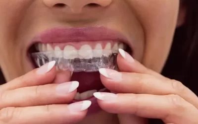 Invisalign Redondo Beach: Clear Aligner Therapy for Discreet Orthodontic Correction